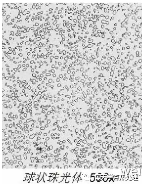 1649921032817616.png 球狀珠光體.png